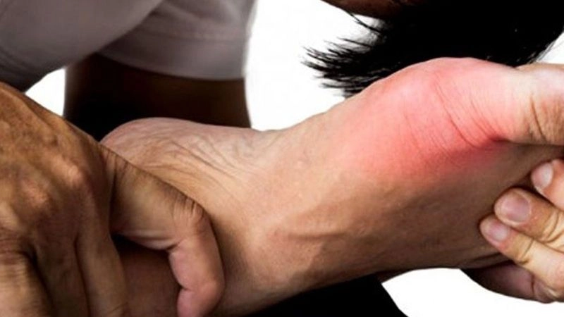 bệnh gout có thể làm cho người bệnh căng thẳng, đau đớn và mất ngủ nhưng gout là bệnh lành tính và có thể khống chế bằng thuốc