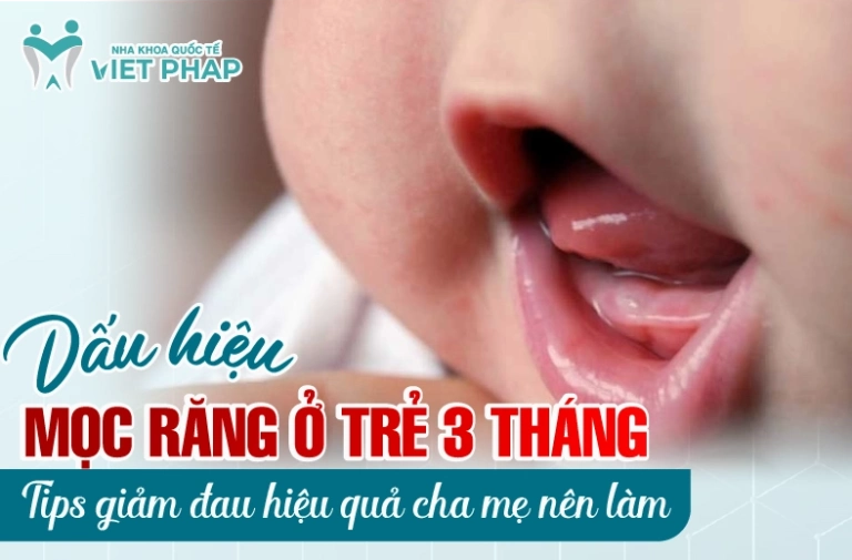 Dấu hiệu mọc răng ở trẻ 3 tháng tuổi và cách chăm sóc