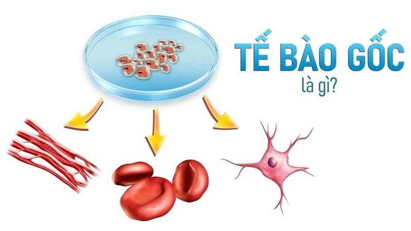 Khám phá liệu pháp tế bào gốc chữa bệnh gì