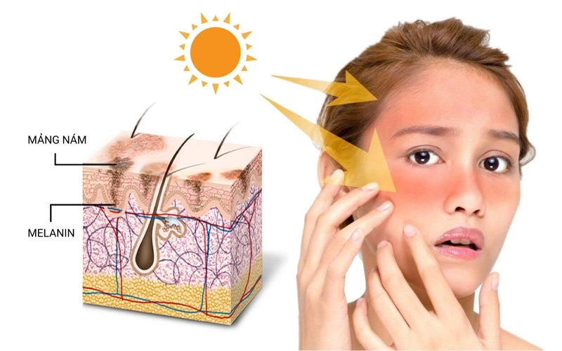 Tìm hiểu Melanin là gì