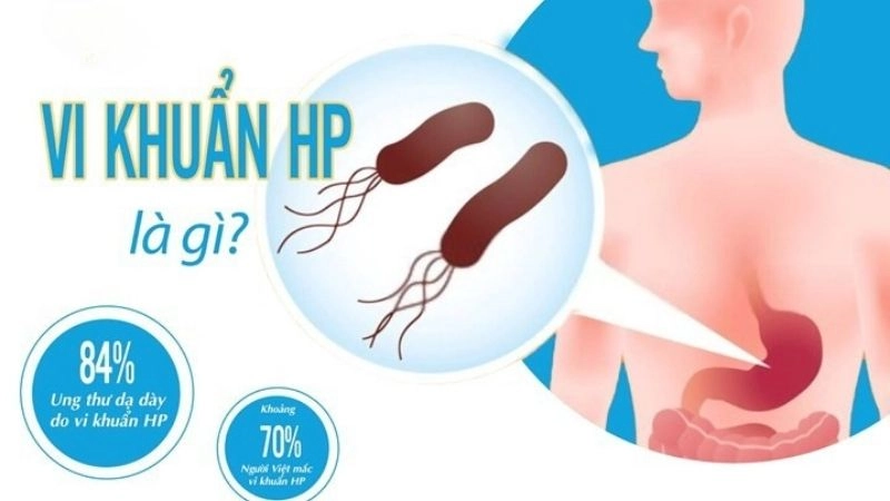 Vi khuẩn HP (Helicobacter pylori) là vi khuẩn tồn tại và phát triển trong dạ dày của con người