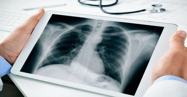 X-ray là gì? Khám phá kỹ thuật chẩn đoán hình ảnh cốt lõi